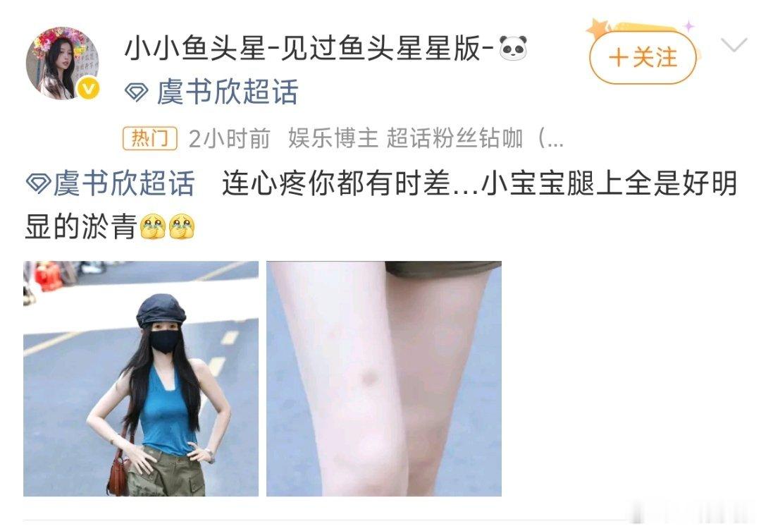 虞书欣大腿淤青多心疼心疼自己的父母不好吗？这点淤青都心疼上了…… 