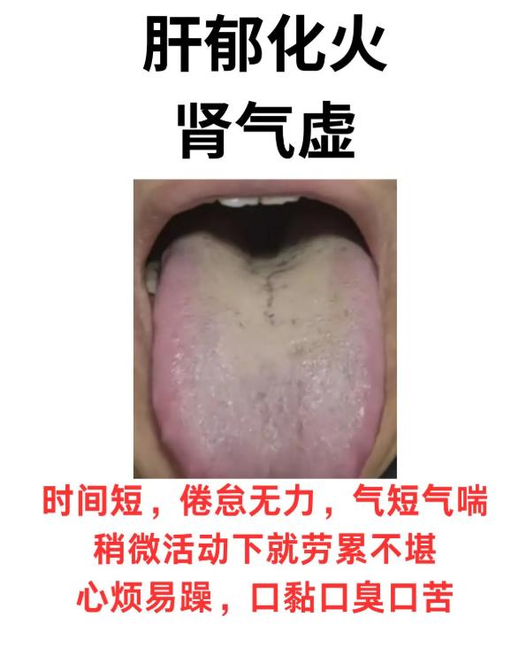 身体有这些不适？看舌头就知道是哪种脏腑亏虚