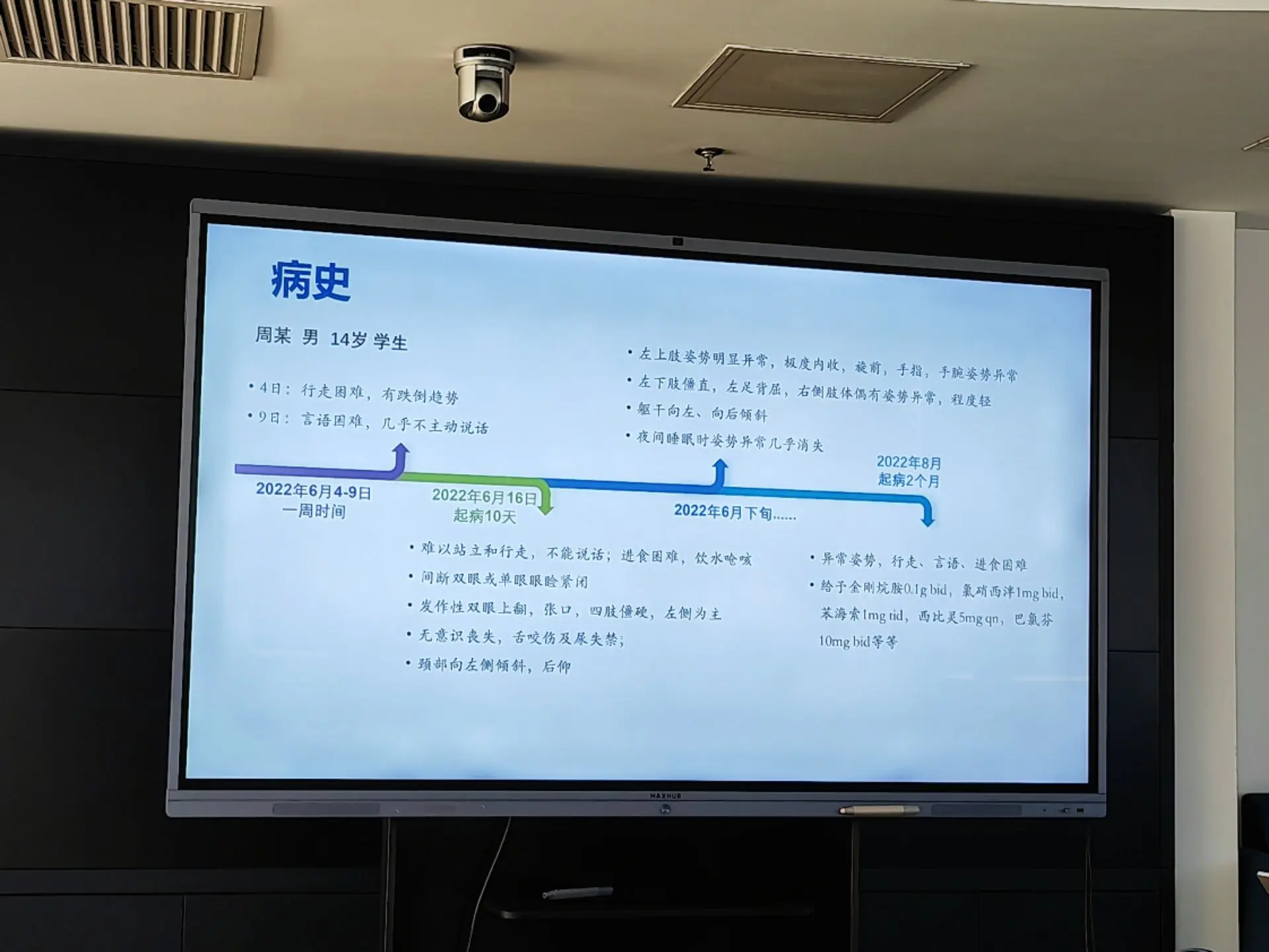 DYT12的诊断标准及临床特点。