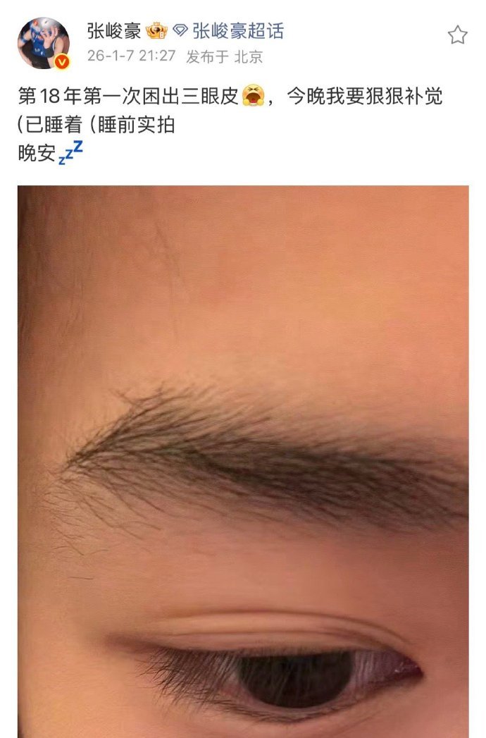 张峻豪第一次困出三眼皮张峻豪回应双眼皮 张峻豪回应双眼皮：困的 