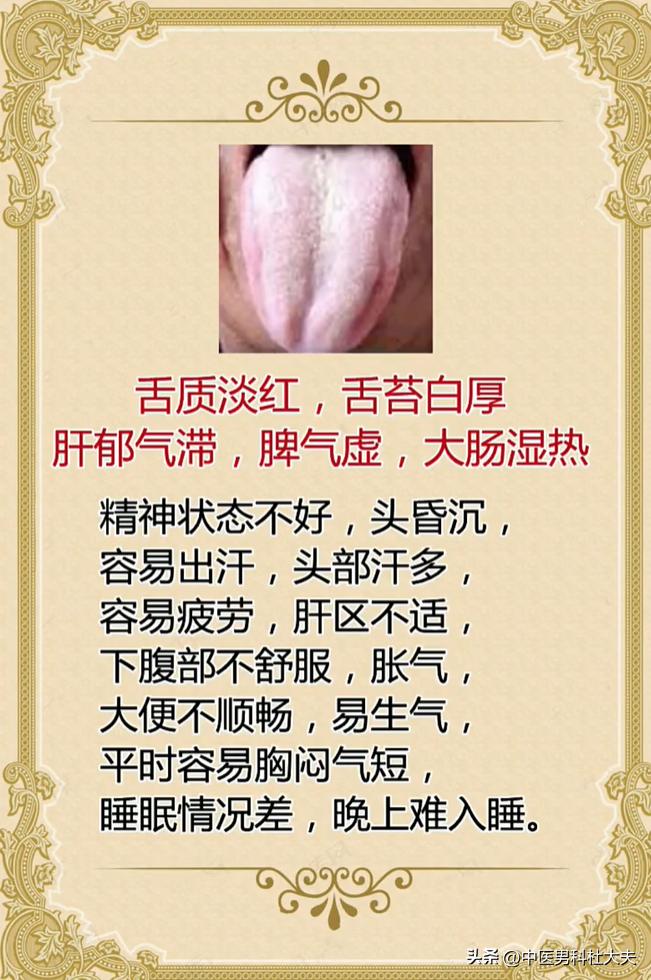 舌苔白厚伴随这些表现，多是肝郁脾虚