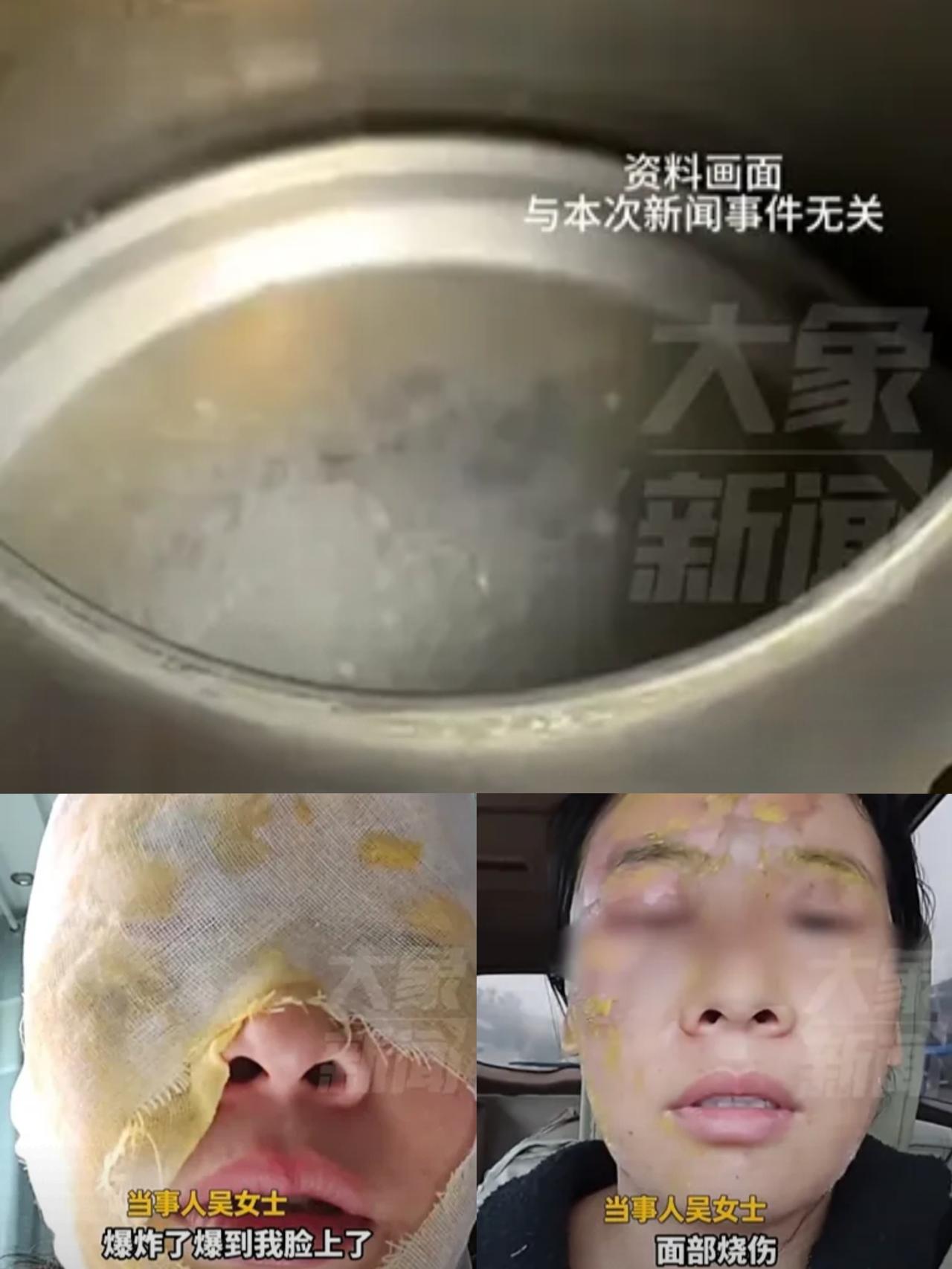 河北邯郸，女子为了去水垢，竟然直接将醋和白糖放进去烧，谁知道刚揭开盖子那一瞬间，