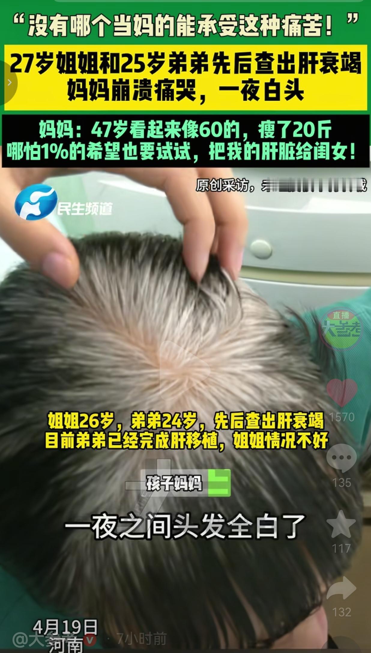 27岁姐姐和25岁弟弟双双肝衰竭，47岁妈妈白了头：我愿把肝给女儿！
 
世界上