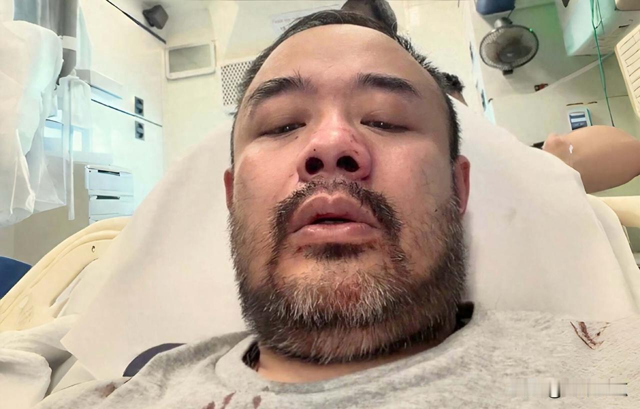 直播时被人冲进来打，血滴在手机镜头上，邵子风没还手，警察很快抓了人。这事发生在2