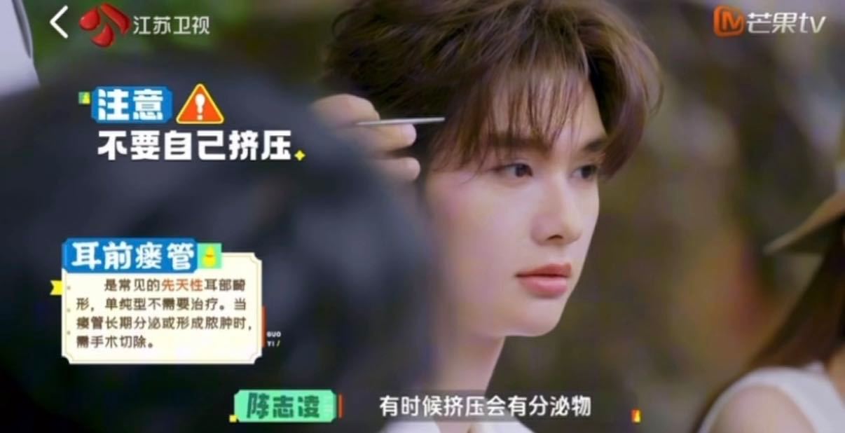 高卿尘先天性耳前瘘管 高卿尘耳前瘘管 耳朵有小孔的快看过来！高卿尘同款先天性耳前