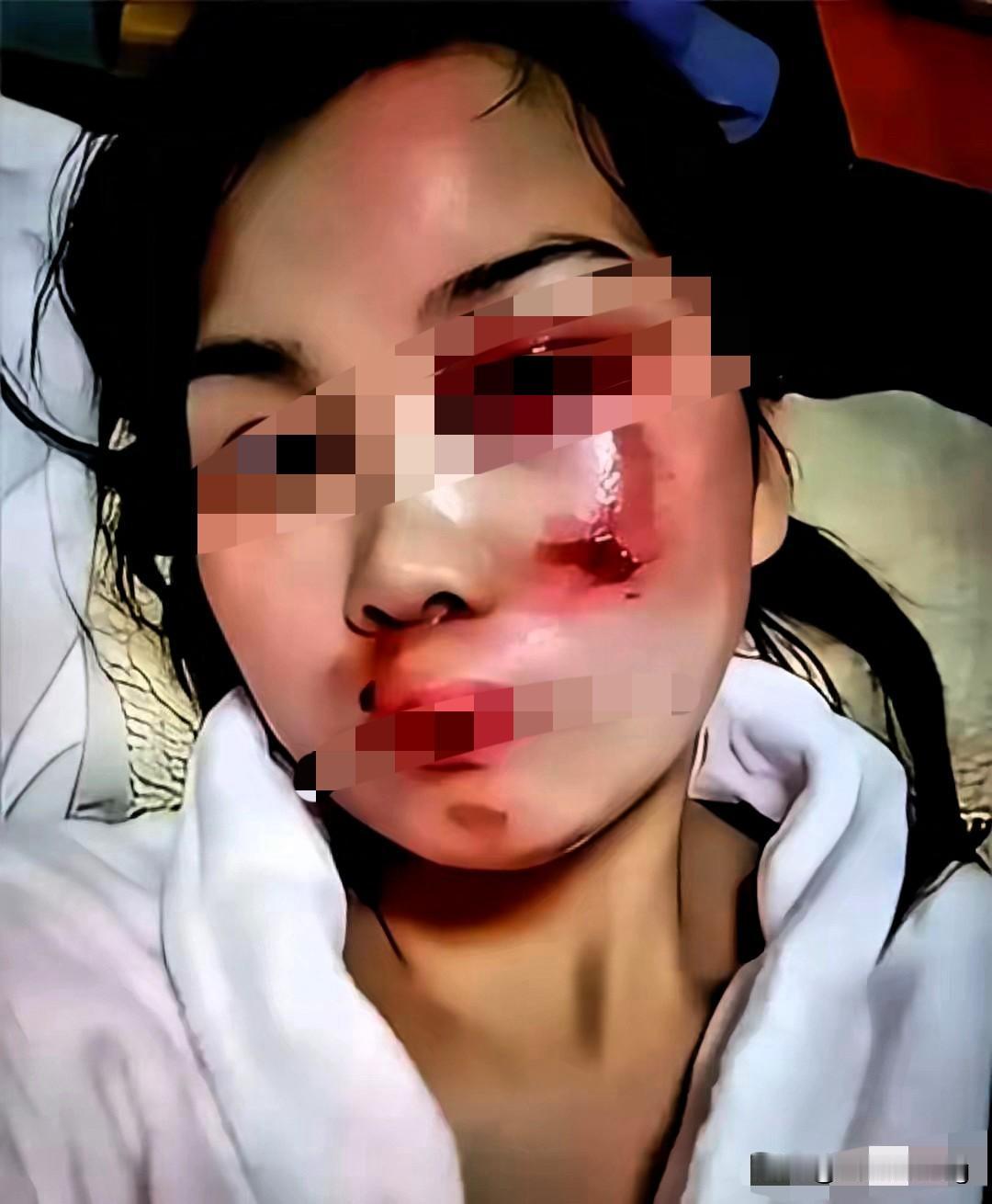 襄阳刘女士这下算是彻底栽跟头，悔青肠子都没用！躺在医院里的那一刻，她心里悔的，怕