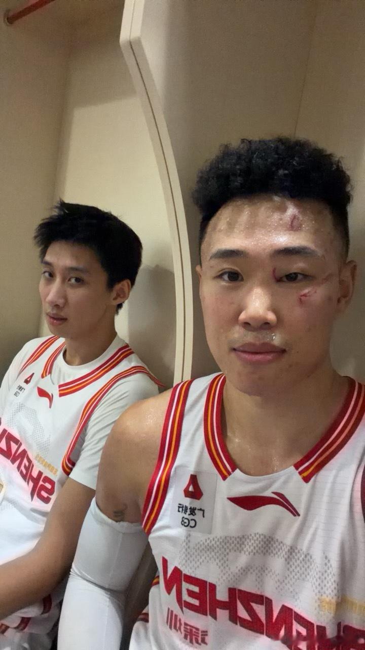 CBA绝对是世界上对抗最激烈的联赛，你看贺希宁打完一场比赛脸都被挠成啥样了，不仅