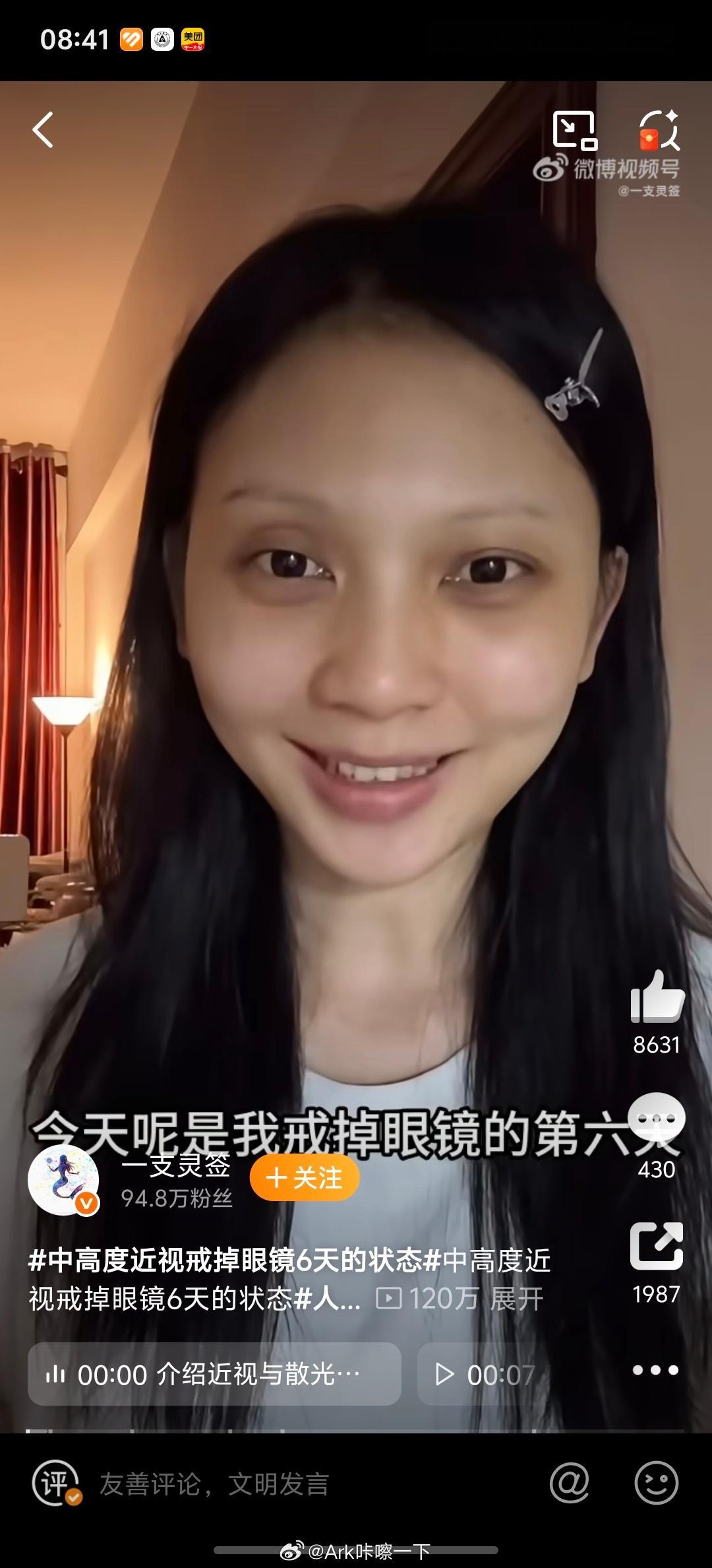 中高度近视戒掉眼镜6天的状态戒掉眼镜的第六天，你这个黑眼圈也很明显啊 ​​​