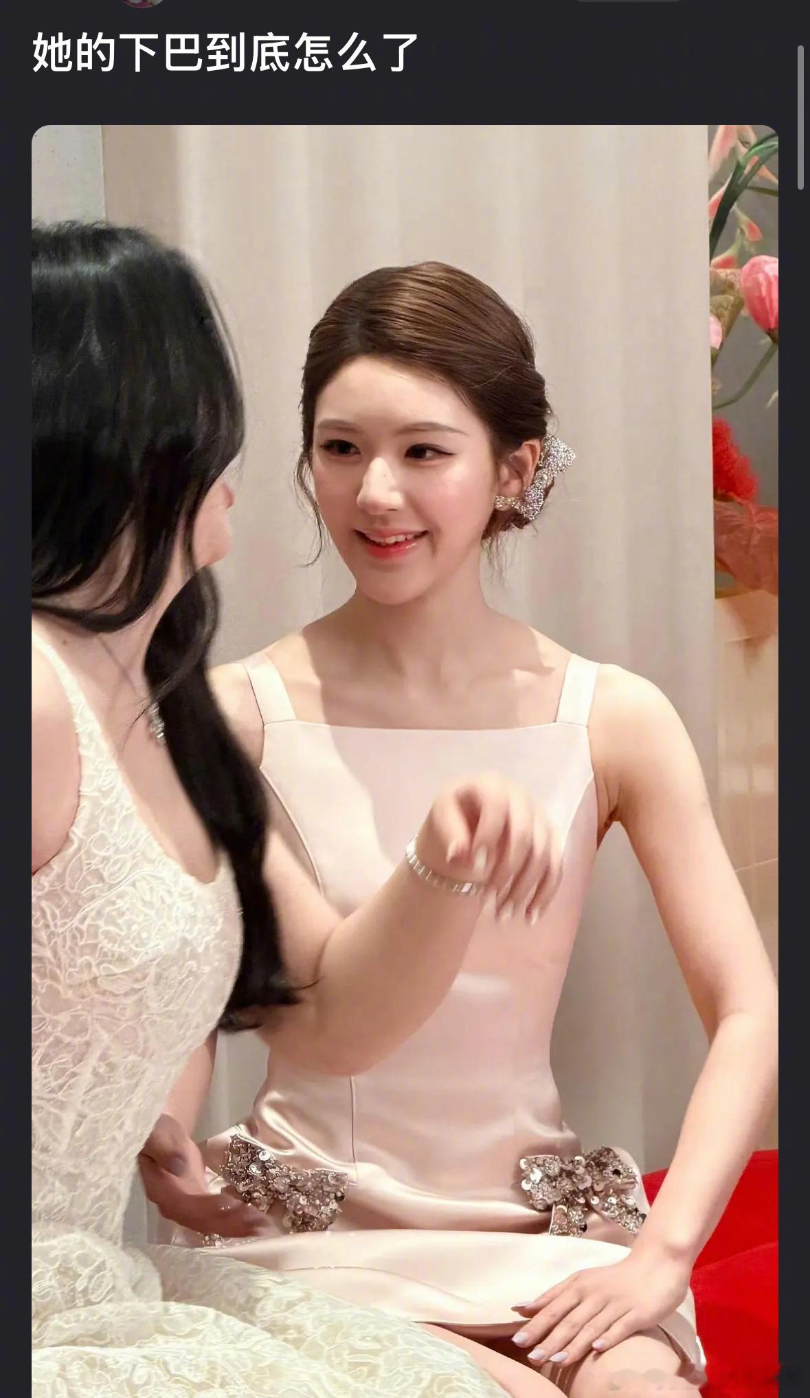 赵露思的下巴很奇怪吗？大家觉得怎么样呢？