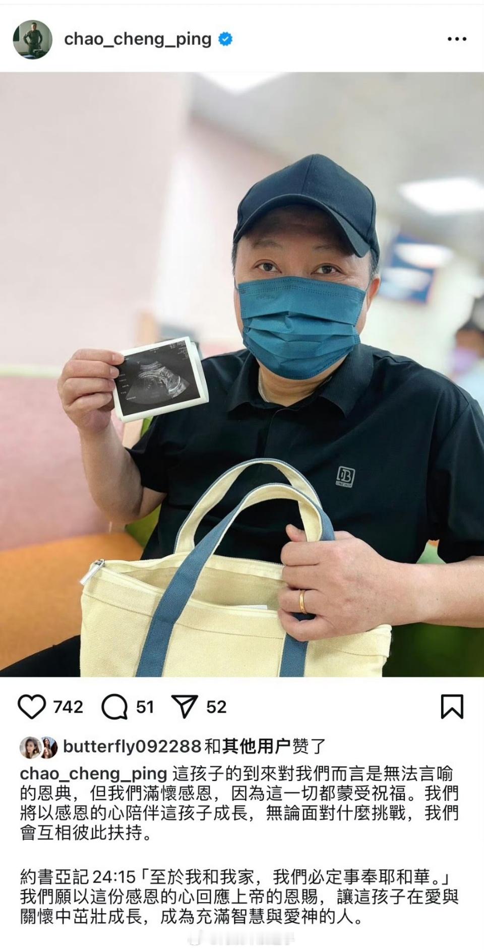 #赵正平老婆怀孕##赵正平妻子怀孕# 赵正平官宣妻子怀孕 ​​​