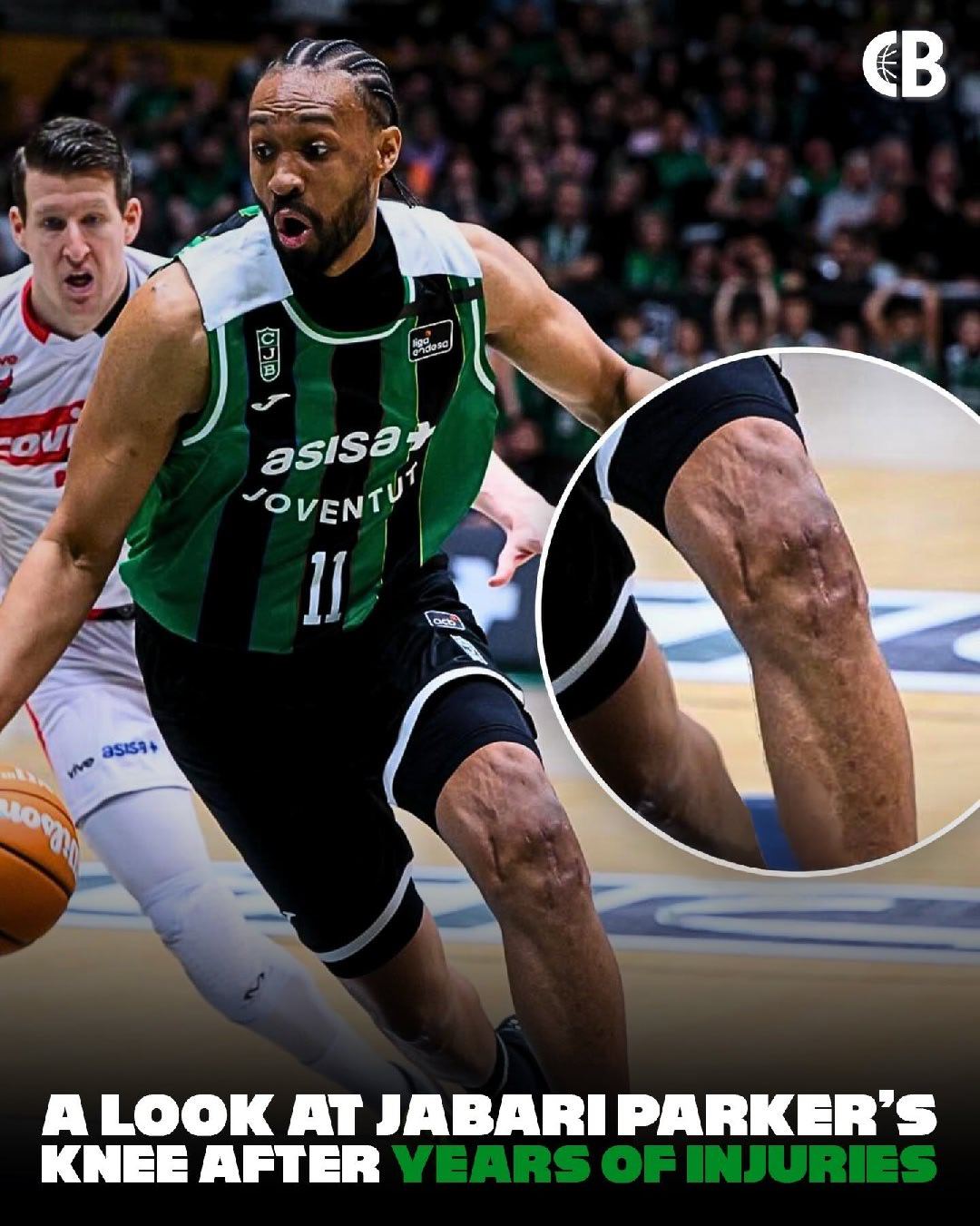 在欧洲打球的贾巴里帕克的这个膝盖，真的吓到我了……新赛季篮不住NBA