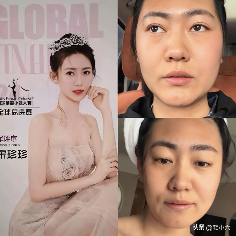 选美冠军变“大妈”？阿珍这脸垮得也太快了吧！
咱就是说，看阿珍以前的照片，那是真