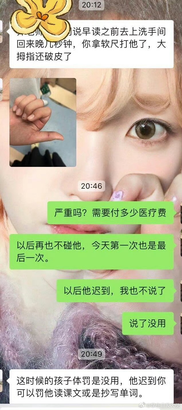 用软尺打了一下学生后