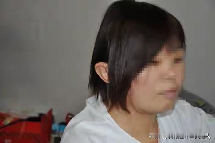 难以想象，现在的医学这么发达了！

山东一女子，意外的让左耳与头皮一同撕脱。原本