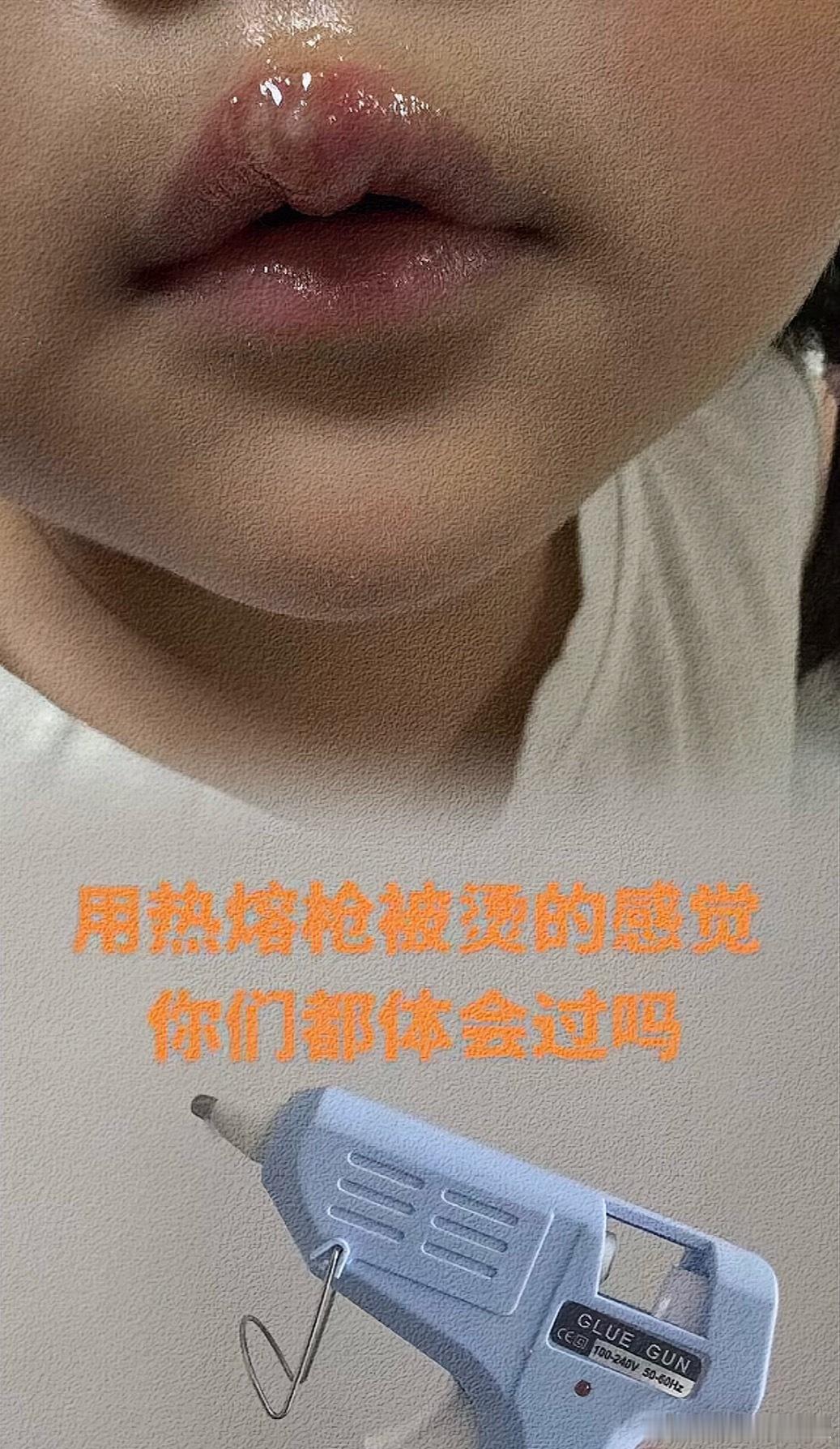 看了视频，真的恨的我牙痒，这种人不只不配做老师，也不配做人！女童被幼儿园老师用热