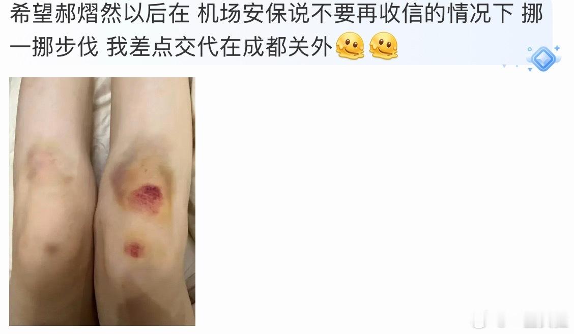昨天在机场被👮拉住的那女的能不能出来讲两句天井踩坏了算谁的啊？这种事件怎么定性