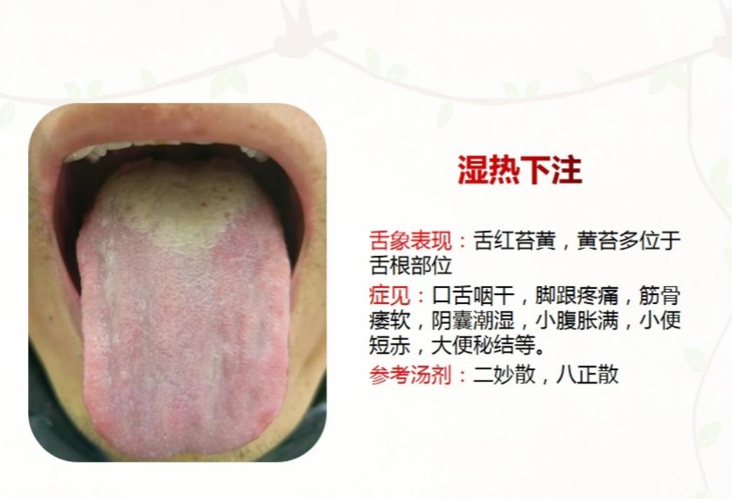 湿热主要分为这三种，今天教你如何分辨，以及调理方法

#健康##中医##舌诊#