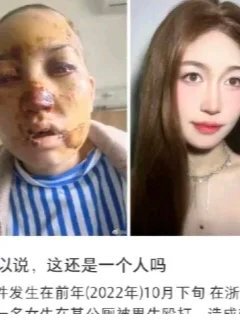 ——当暴力创伤未愈，又遇血癌摧残……---💔 双重打击：从公厕到病房的300天