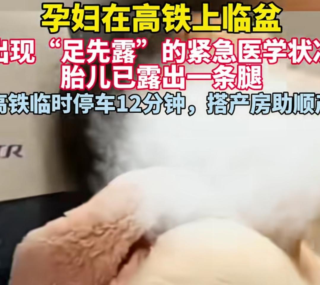 怀孕32周的孕妇在高铁上要生了，而且是腿先出来了，这种状况很紧急的，都是头先出来