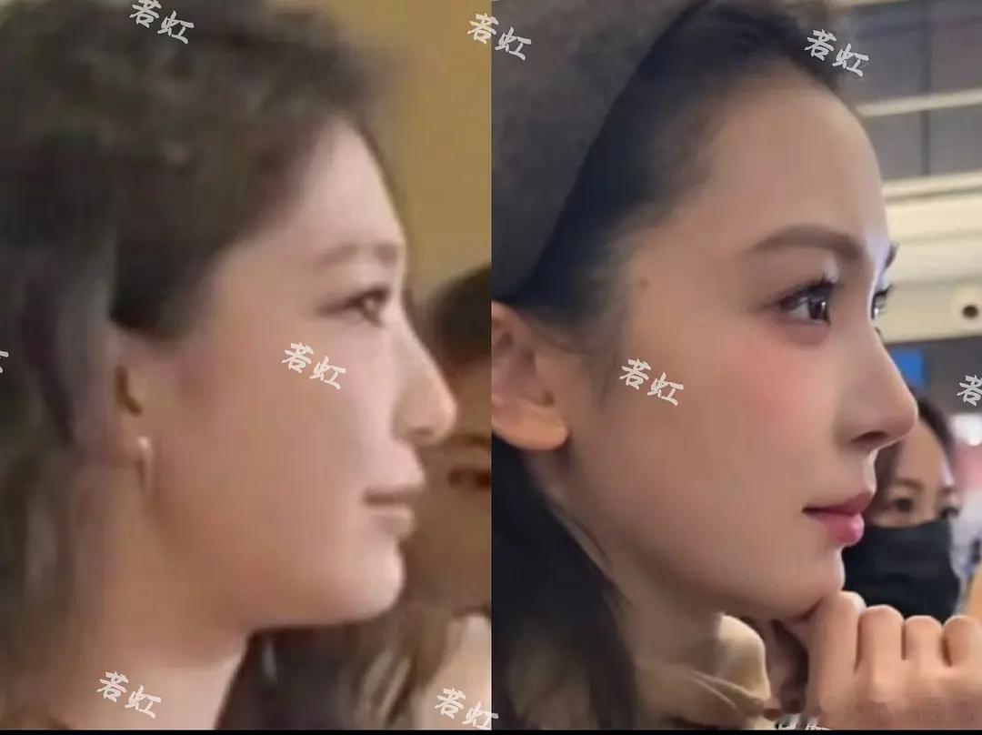 易梦玲之前和现在对比图。。。右图是近期机场照。。。完全赵樱子来的。。。两个人互相