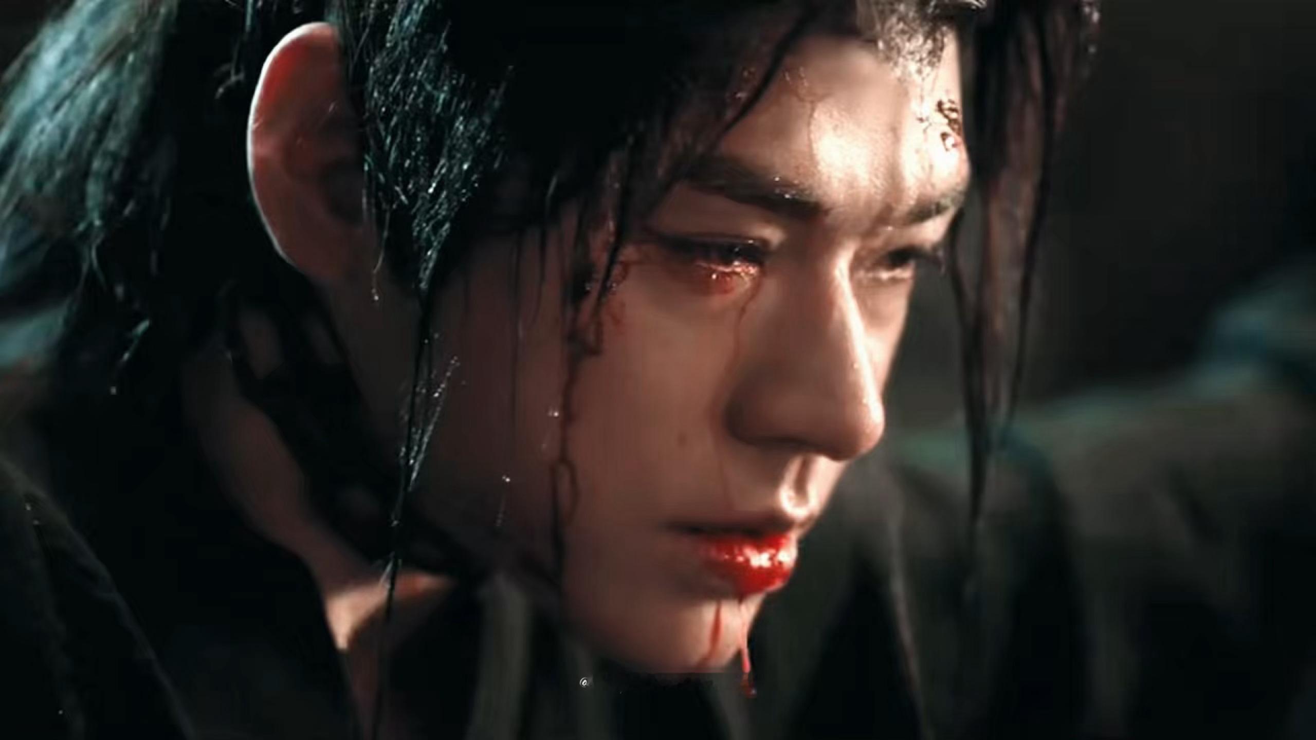 这个战损镜头也好绝😵‍💫感觉给我开疼痛共享了..2027鹅厂片单 ​​​