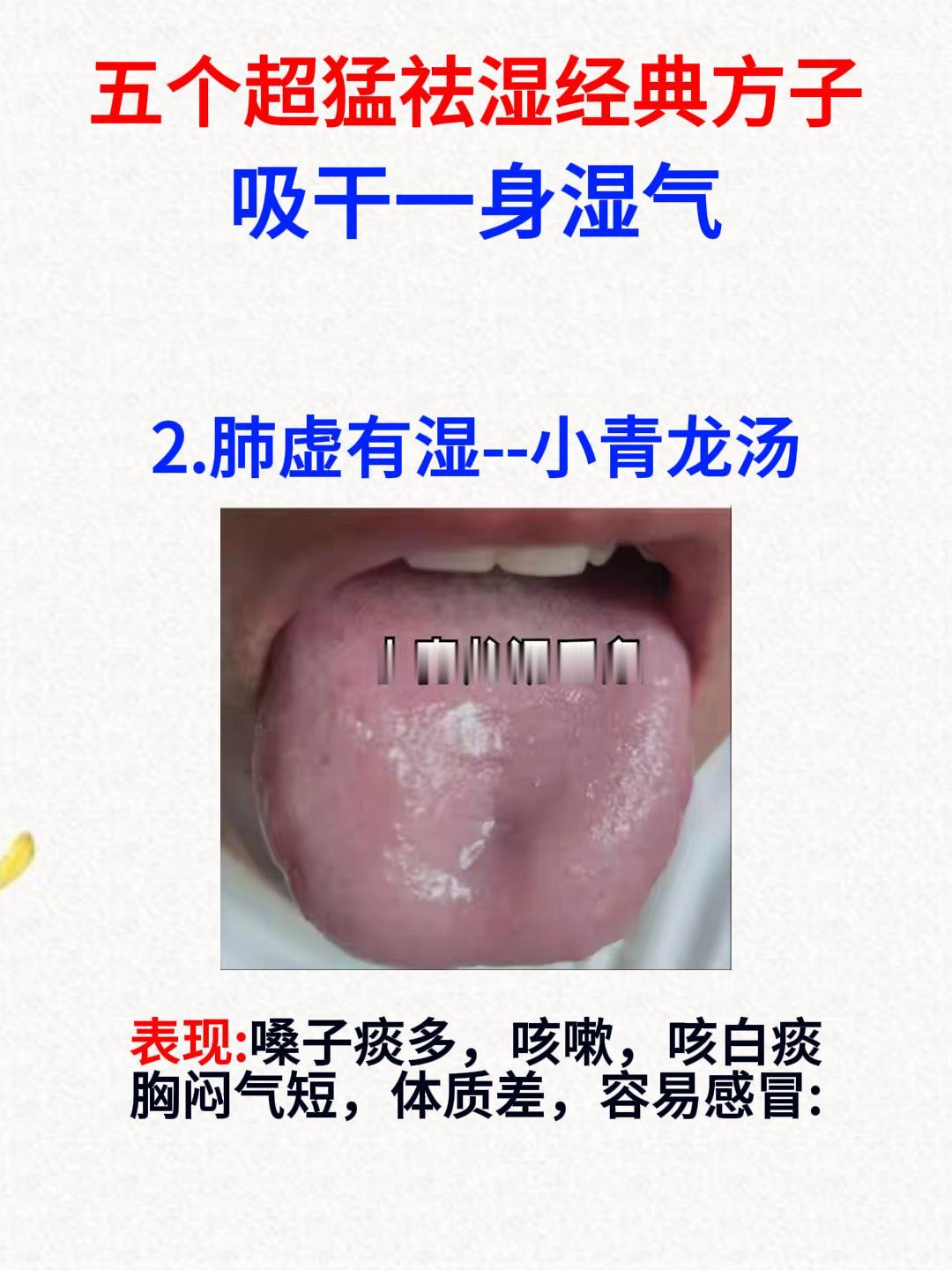 五个祛湿超猛的方子，吸干一身湿气[谢谢][谢谢][谢谢]

1.脾湿——参苓白术