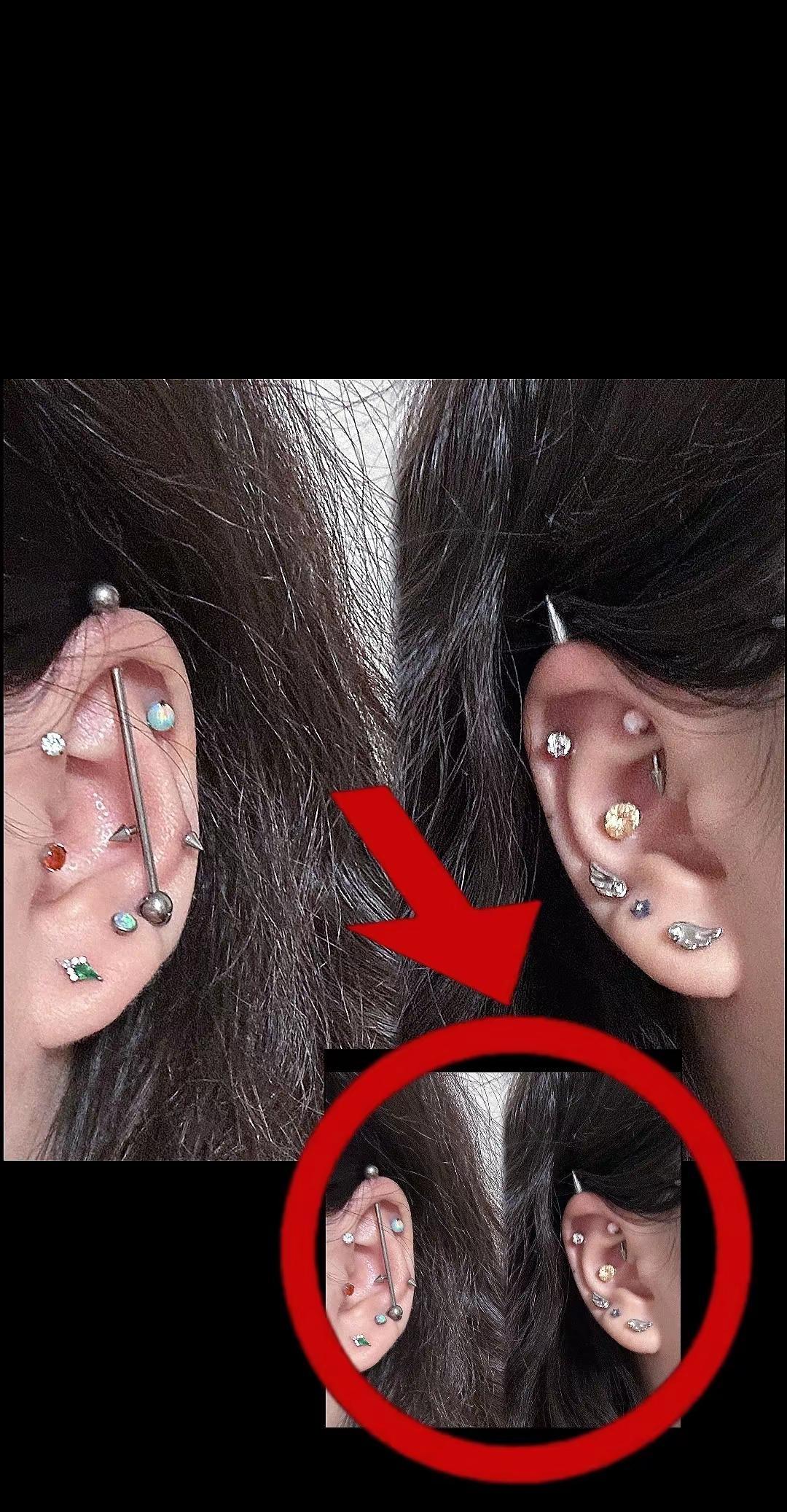 在操场睡觉的时候一个体育生穿钉鞋从我耳朵上碾过去了