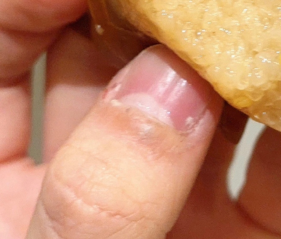 苏新皓每天对自己的大拇指在干什么 