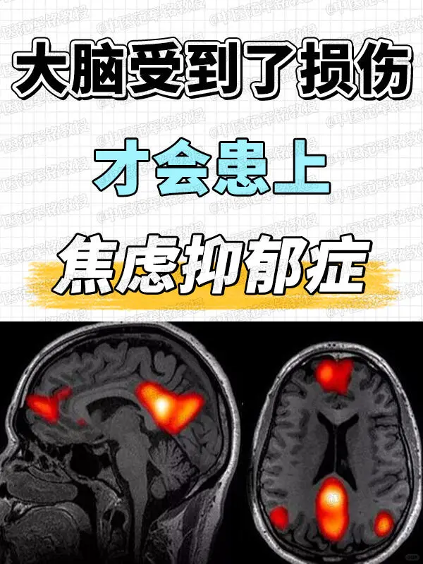 大脑受到了损伤才会患上焦虑抑郁症