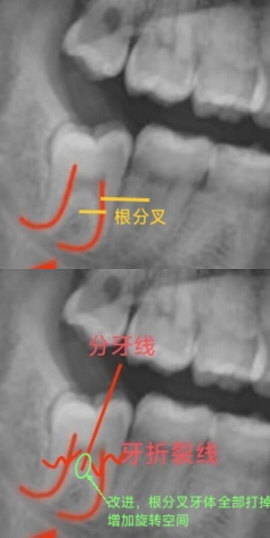 翻车复盘，接上篇