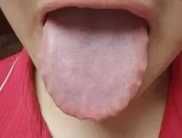 这样的舌头，不用着急补脾，当务之急是补阳！
 
患者：浑身乏力 畏冷怕寒，手脚冰