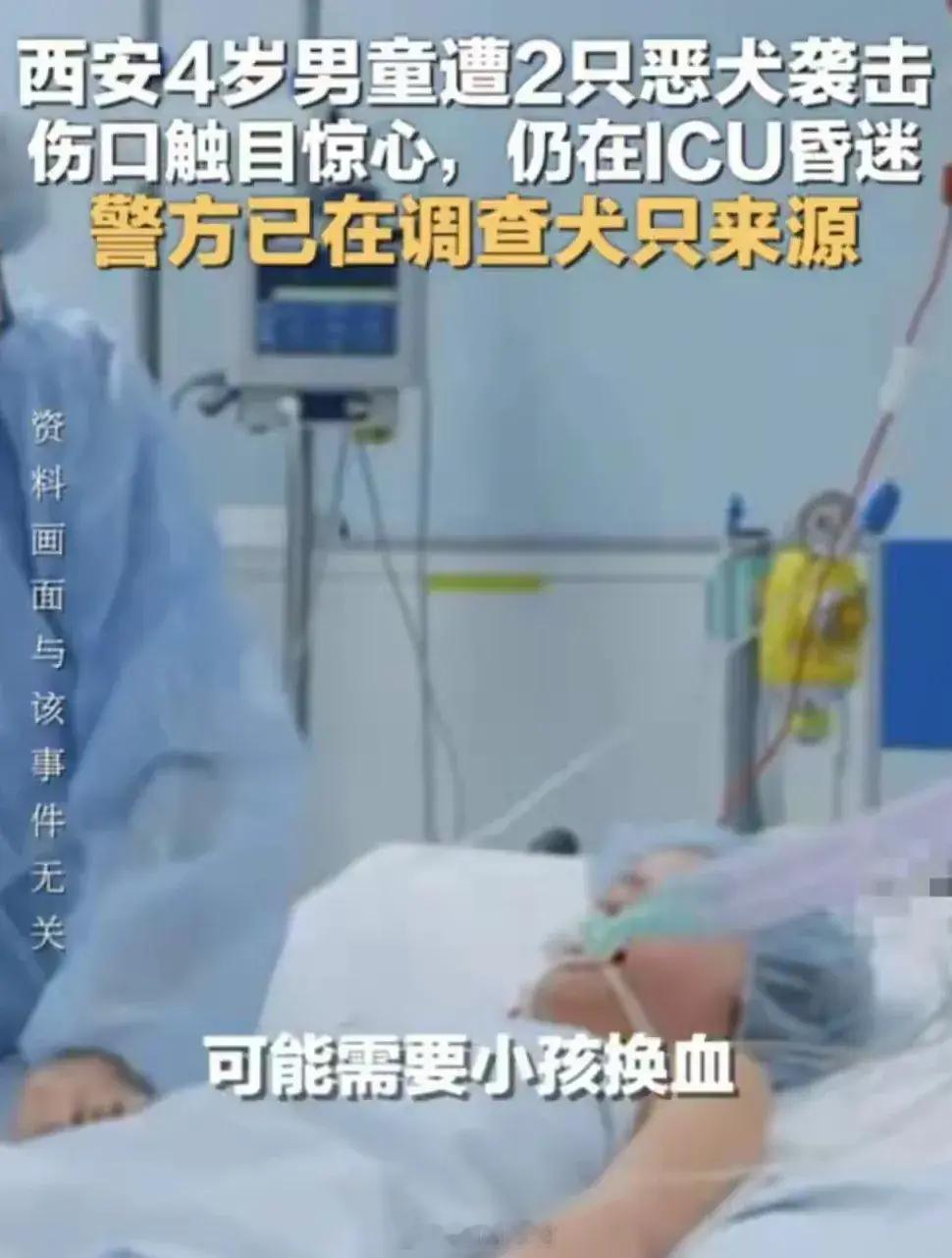 心疼这个孩子，一辈子都毁了！西安灞桥又现恶犬伤人，一个4岁的小男孩被两只恶犬给咬