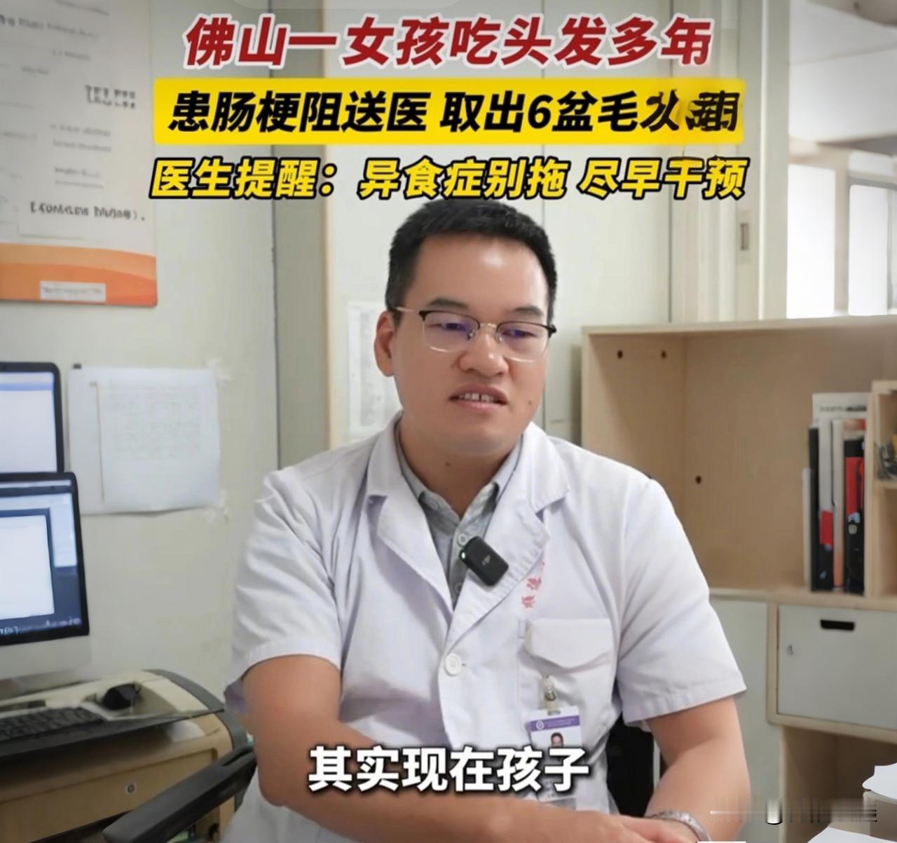 13岁女孩肚里取出6盆头发！不是贪吃，是病！

我活了半辈子，头一回听说有人把头