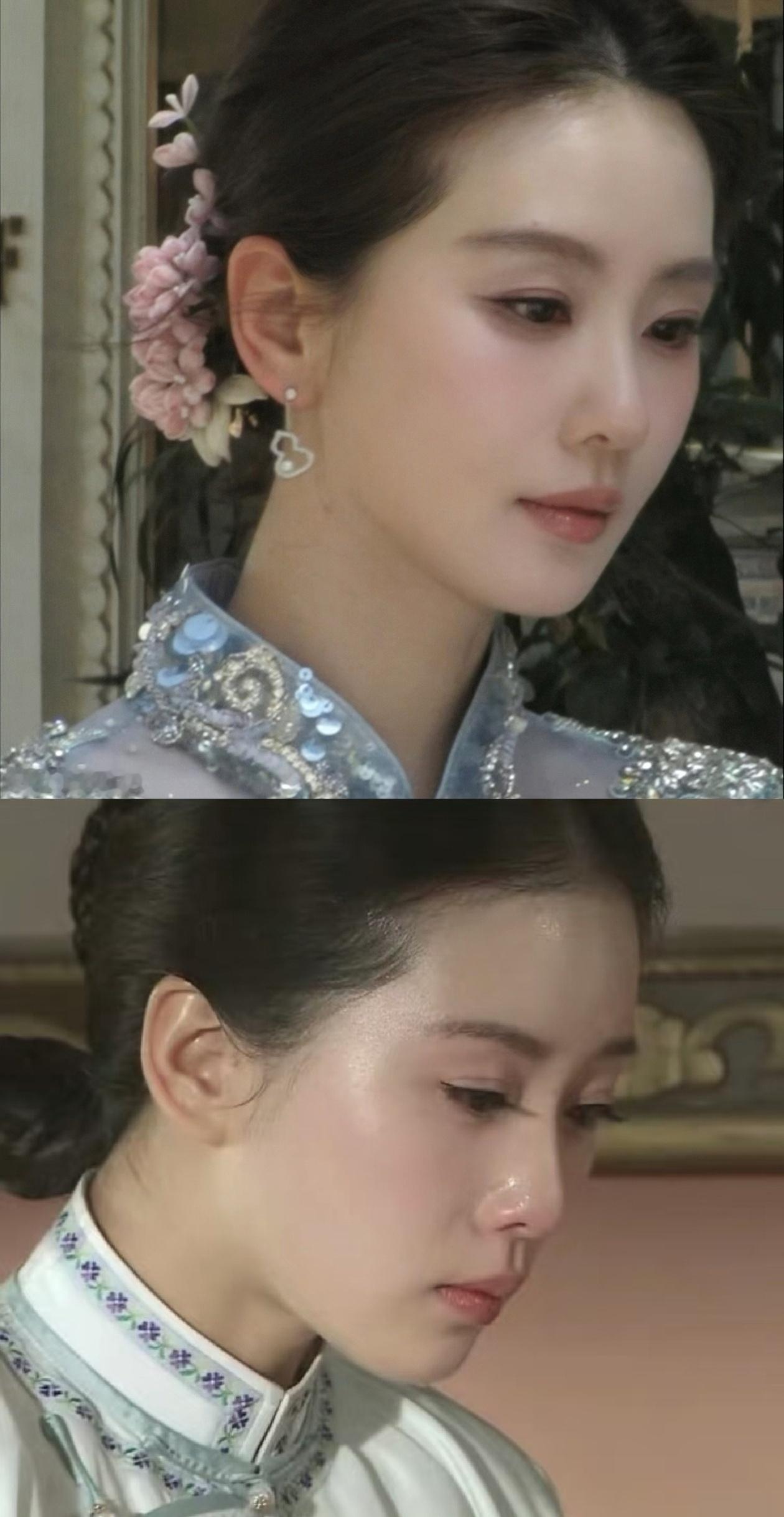 家姐妈生发际线真的回来了耶，一模一样