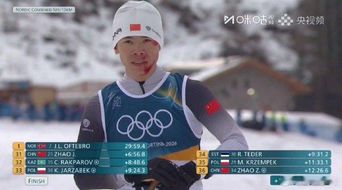 中国队员面带鲜血过终点线米兰冬奥会北欧两项男子标准台＋10KM越野滑雪决赛上，中