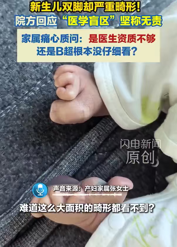 花一万多产检一路绿灯生下来畸形一万多产检一路绿灯，宝宝出生双脚畸形，医学盲区四个