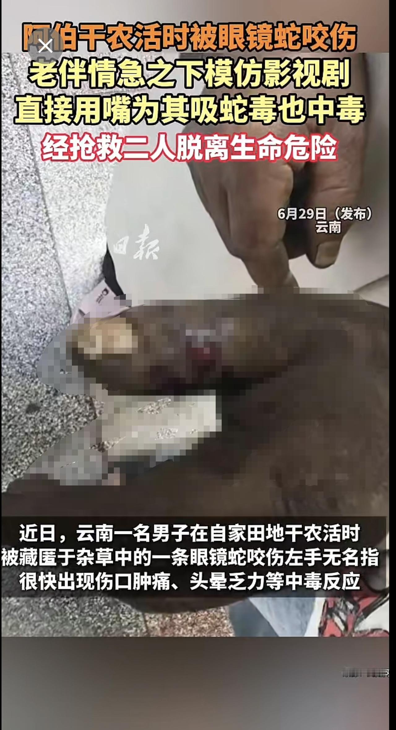 阿伯干农活时被眼镜蛇咬伤 老伴情急之下模仿影视剧直接用嘴为其吸蛇毒也中毒