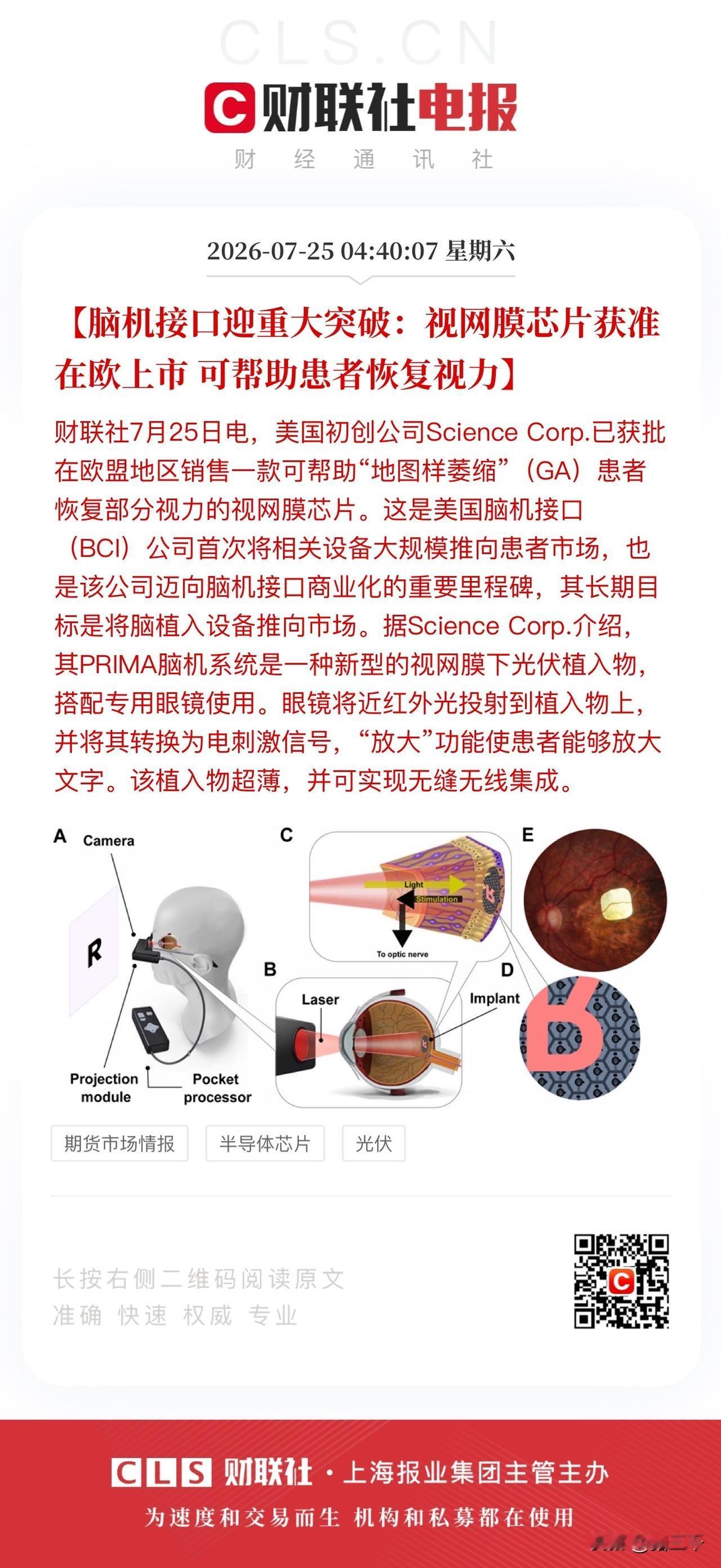 脑机接口应用这下真的照进现实了！
中美脑机前沿研究均不断取得突破：
脑机信号是交