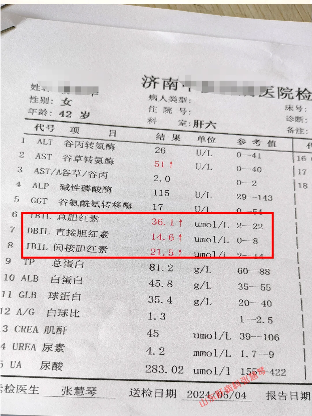 轻微胆红素升高，怎么回事？和肝硬化有关吗