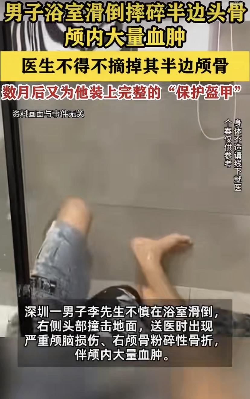 佛山一男子洗澡滑倒，脑袋差点“开了瓢”!这习惯你可能也有
广东佛山的李先生怎么也