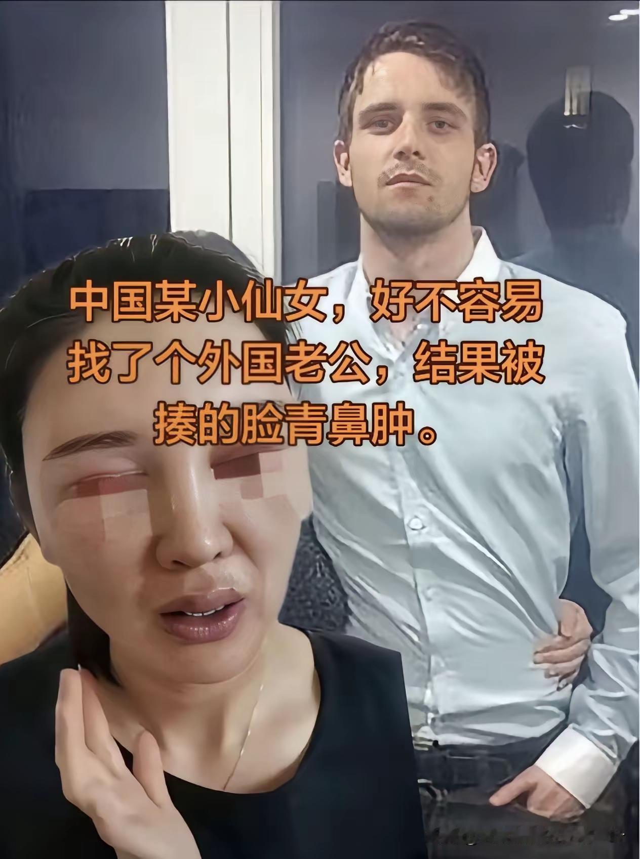 宋晓峰:找老外是你的自由，就问你扛不扛揍吧