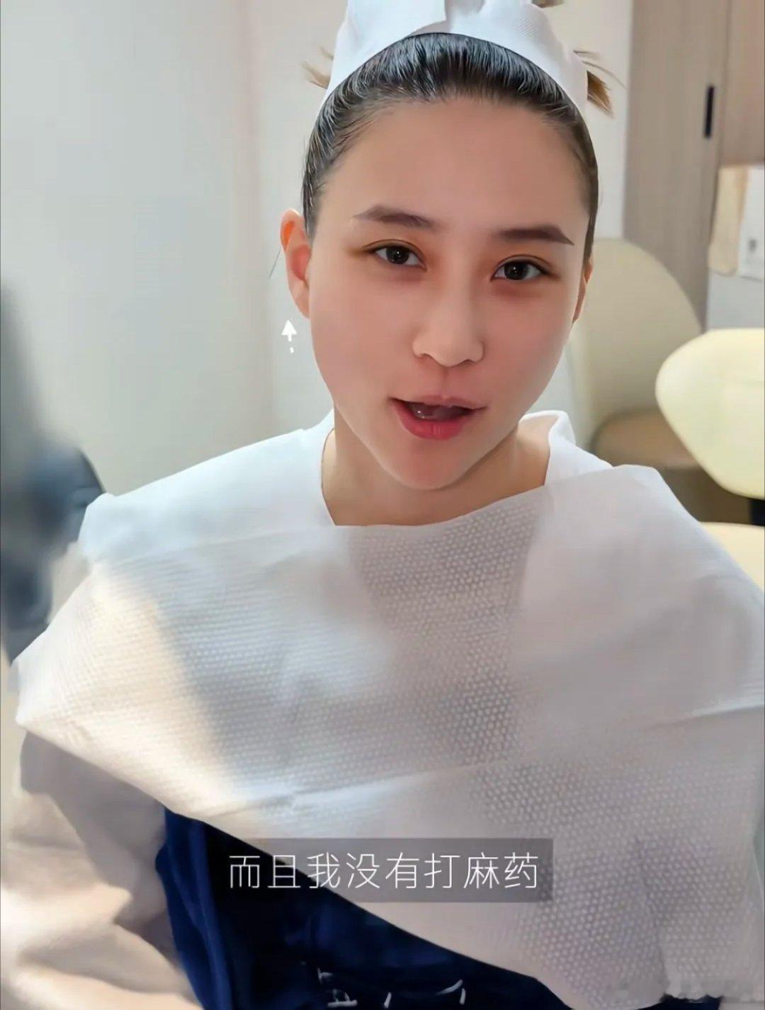 赌王千金何超莲去做医美项目，她没有打麻药，一开始脸上发胀，就像牙齿酸痛的感觉。3