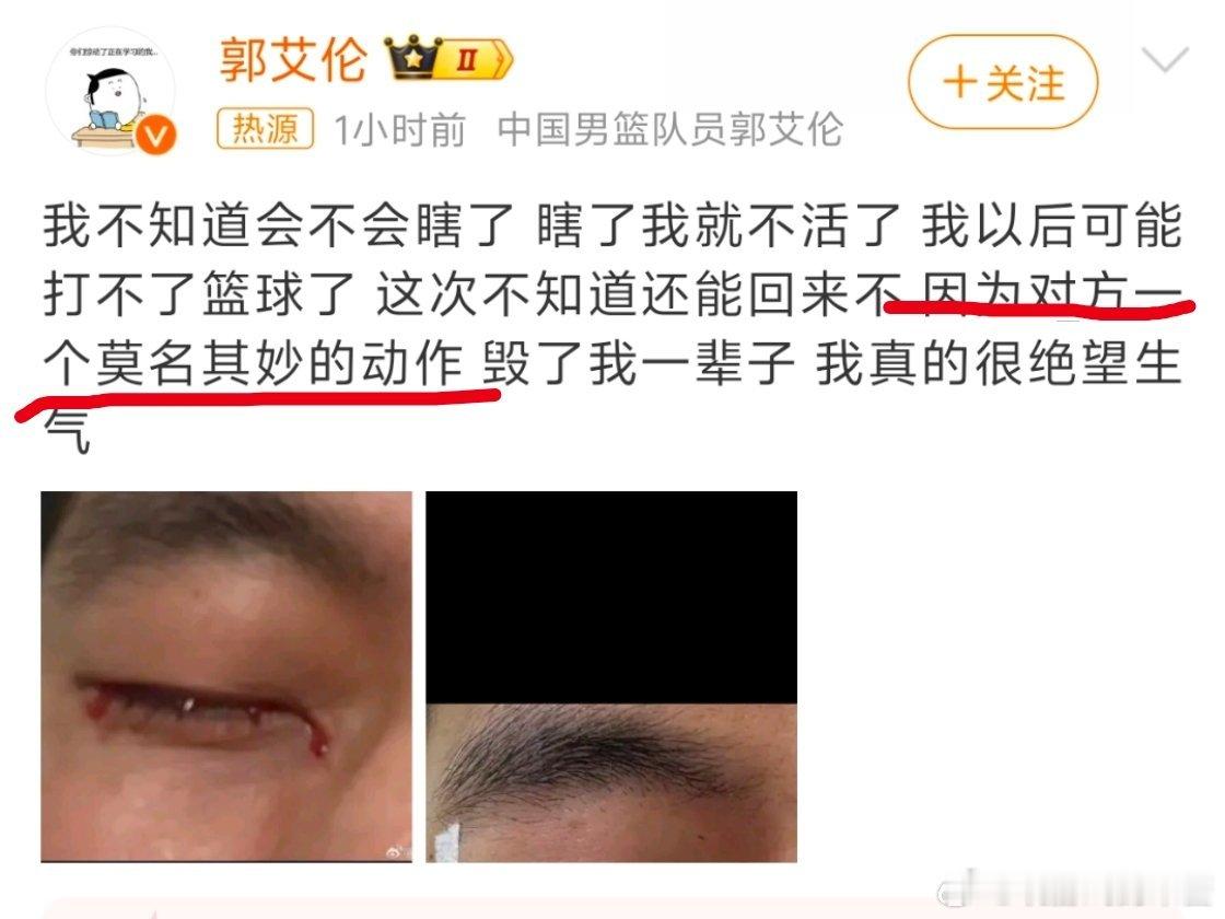 郭艾伦 以后可能打不了篮球了 “对方一个莫名其妙的动作”是指身体攻击吗……能出来