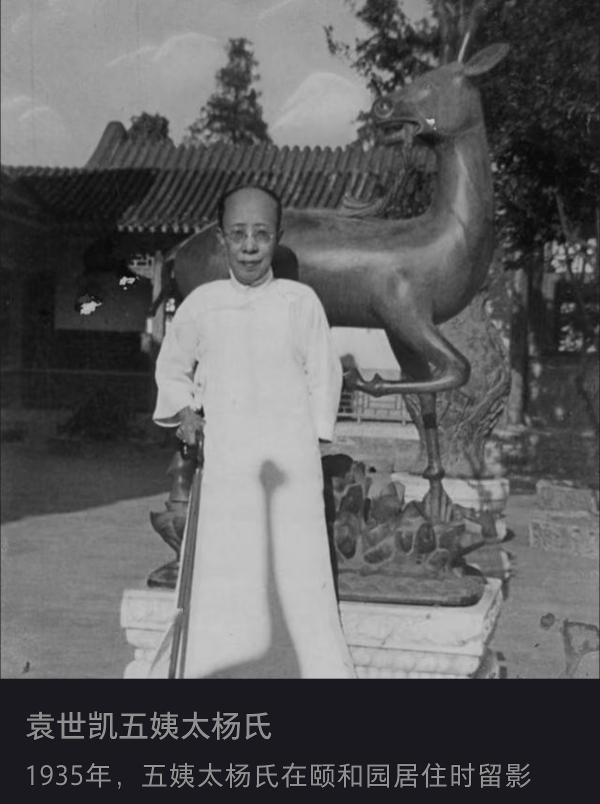 这是袁世凯五姨太?脱发秃顶了? 女性相对男性来说，是很难出现这种前额大面积脱发的