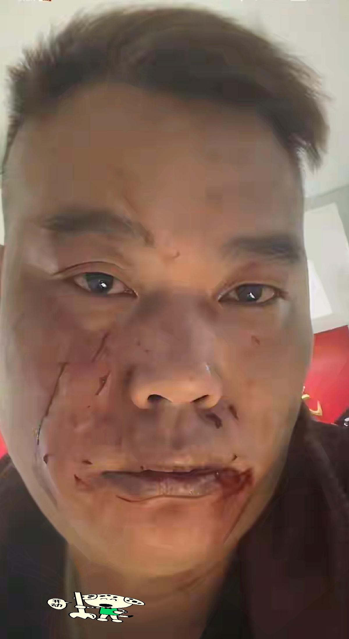 20万彩礼锁死的婚姻，到底该止损还是硬扛？
 
刷到有人吐槽被老婆“破相”，想离