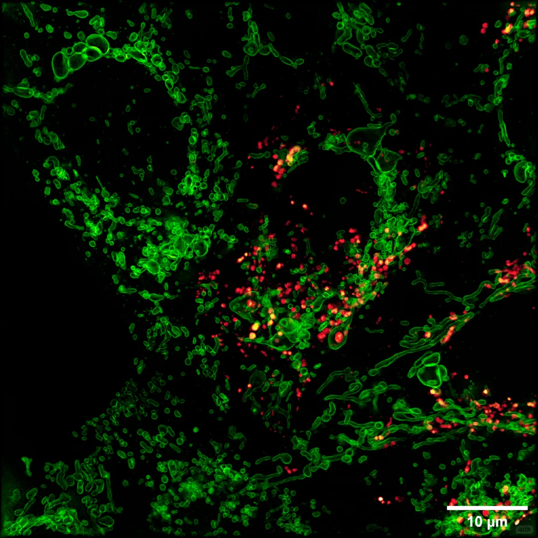 线粒体外膜+溶酶体，超分辨成像，轻松拿捏