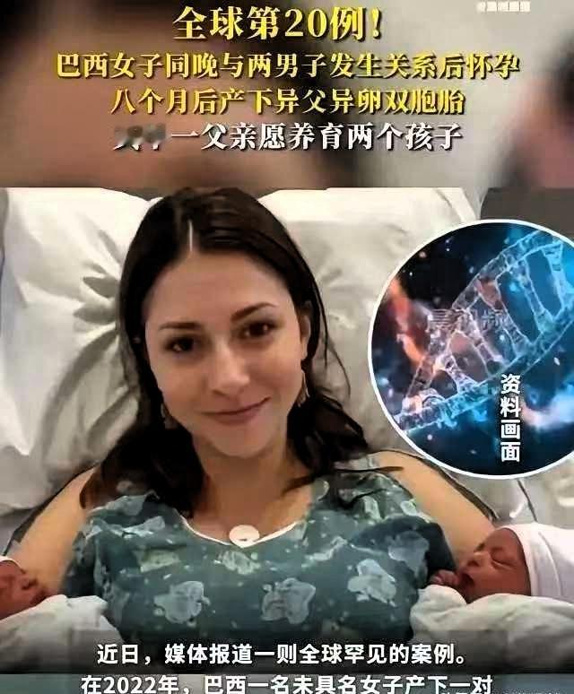 全球仅20例！巴西女子同一晚与2名男子发生了关系。不久后，女子后怀孕了，并且还生