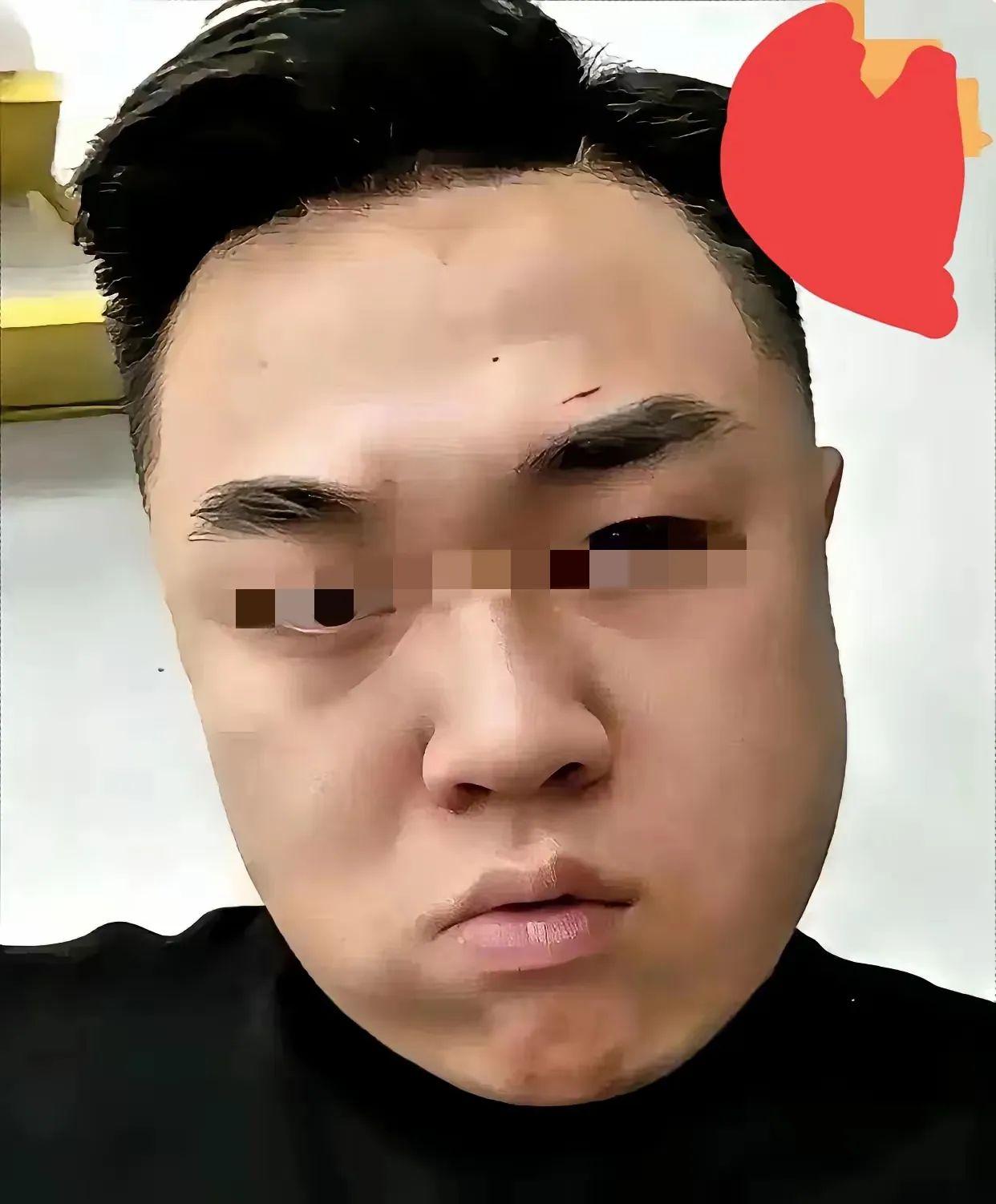 一纸鉴定结果出来，有人彻底坐不住了。不是赔不起钱，而是能走的捷径，全被堵死了。轻