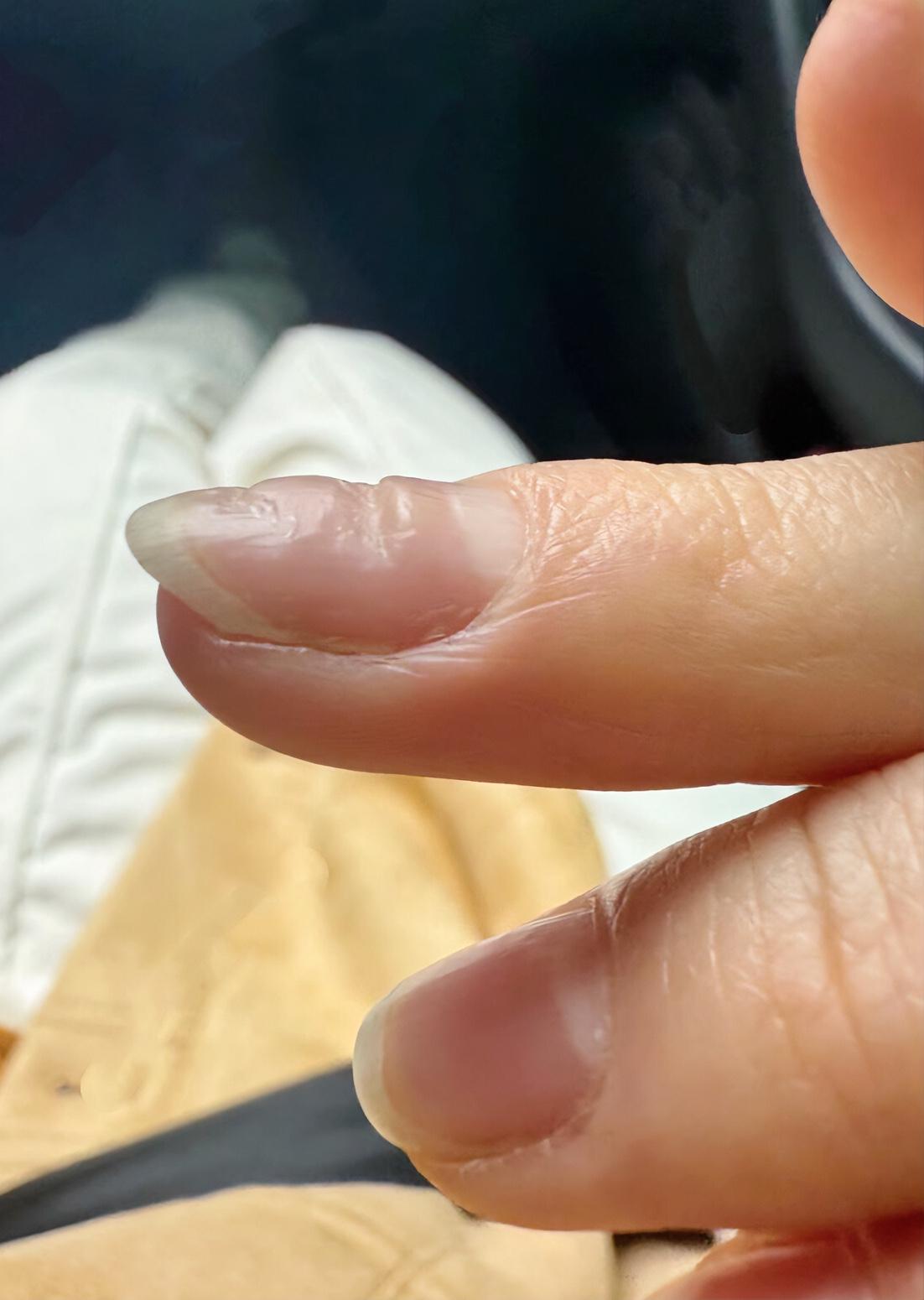 为什么指甲会这样我新发布的内容被官方推荐啦！👍你也快来发布一条吧！带记录真实生