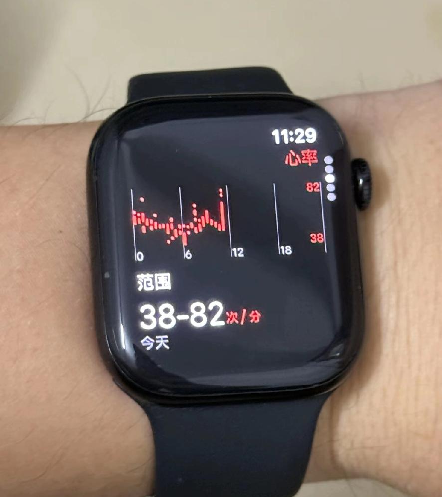 我是真活的没心没肺，没有了欲望，眼里只有昨天、今天、明天，昨天之前的事全部不记得